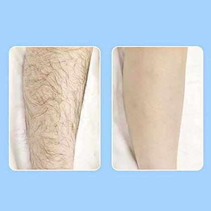 Obrázek z Ruční depilátor